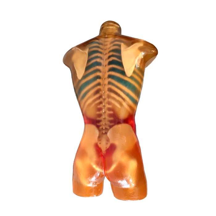 Torso MRI