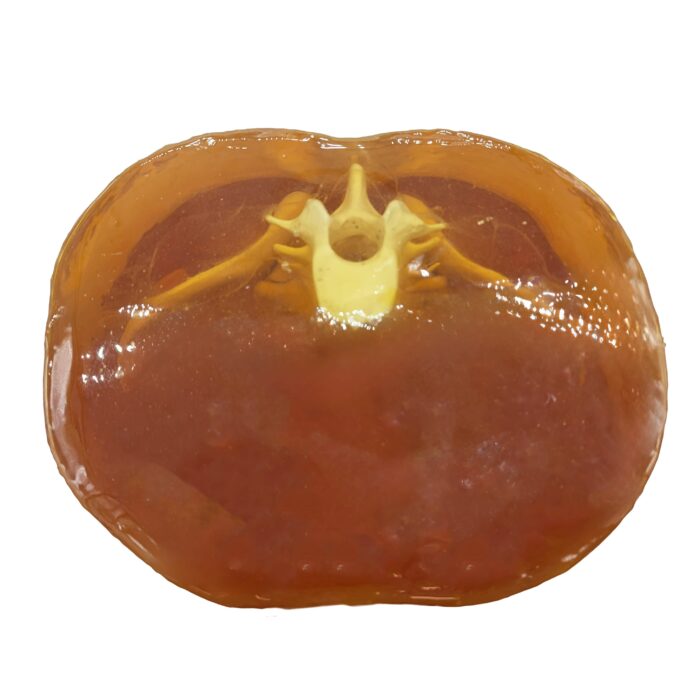 Pelvis Phantom for X-Ray, CT, MRI, Ultrasound