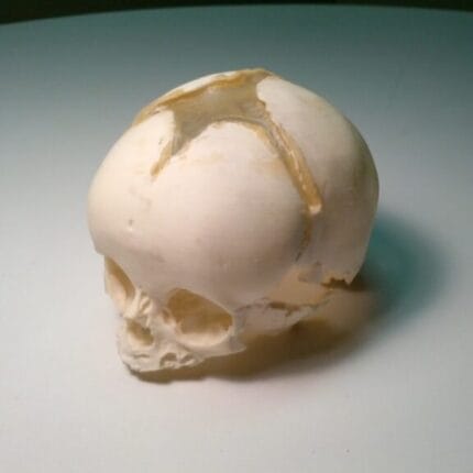 Acoustic Characterization of Two Pediatric Skull Phantoms