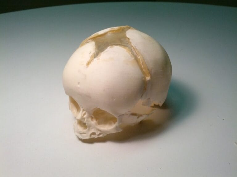 Acoustic Characterization of Two Pediatric Skull Phantoms