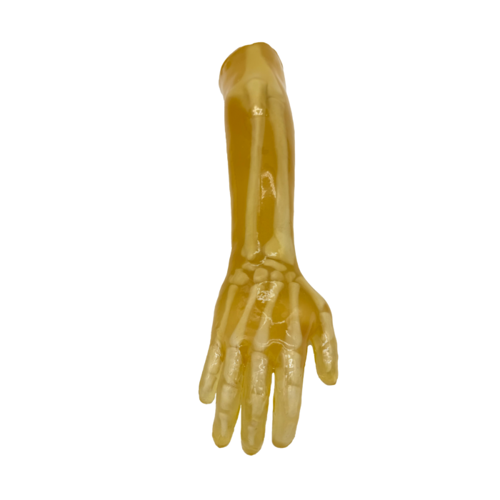 Radiology training arm phantom