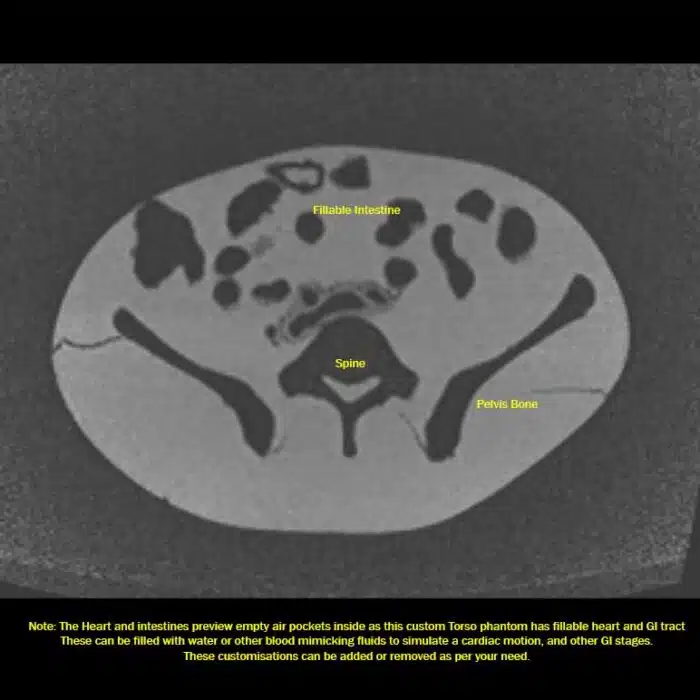 MRI T1 Axial View
