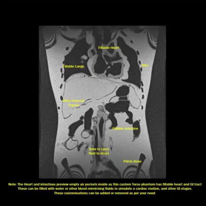 MRI T1 Coronal View
