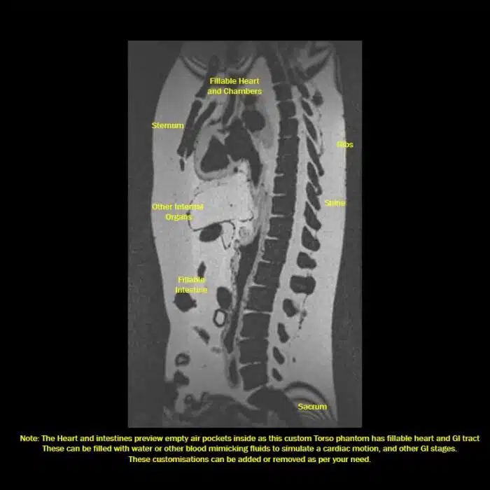 MRI T1 Sagittal View
